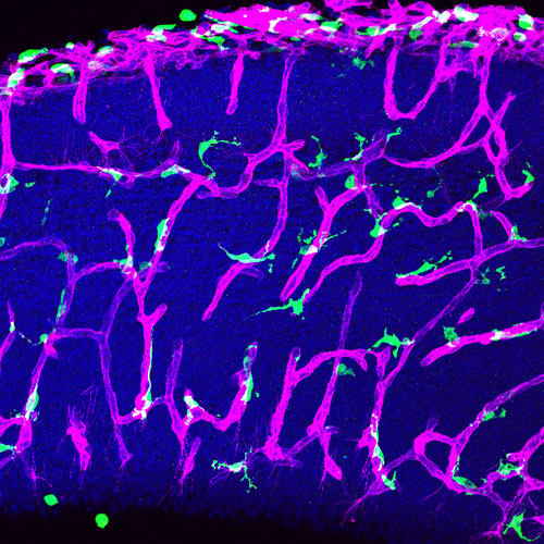 Immunomarquages de sections coronales de cerveaux embryonnaires de souris 